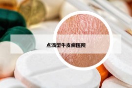 點(diǎn)滴型牛皮癬醫(yī)院