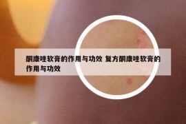 酮康唑軟膏的作用與功效 復方酮康唑軟膏的作用與功效