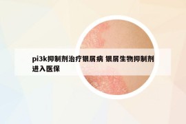 pi3k抑制劑治療銀屑病 銀屑生物抑制劑進(jìn)入醫(yī)保