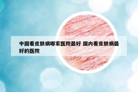 中國看皮膚病哪家醫(yī)院最好 國內(nèi)看皮膚病最好的醫(yī)院