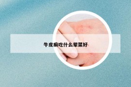 牛皮癬吃什么葷菜好