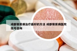 成都銀屑病治療最好的方法 成都銀屑病醫(yī)院掛號咨詢