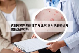 貴陽看銀屑病有什么好醫(yī)院 貴陽銀屑病研究院能治得好嗎