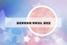 蒲地黃銀屑病 銀黃滴丸 蒲地藍(lán)