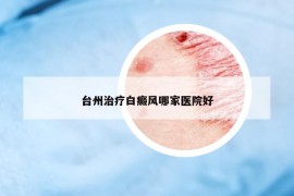 臺州治療白癜風(fēng)哪家醫(yī)院好