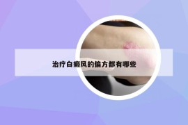 治療白癜風(fēng)的偏方都有哪些