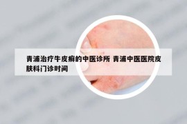 青浦治療牛皮癬的中醫(yī)診所 青浦中醫(yī)醫(yī)院皮膚科門診時(shí)間