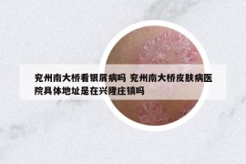 兗州南大橋看銀屑病嗎 兗州南大橋皮膚病醫(yī)院具體地址是在興隆莊鎮(zhèn)嗎