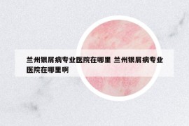 蘭州銀屑病專業(yè)醫(yī)院在哪里 蘭州銀屑病專業(yè)醫(yī)院在哪里啊