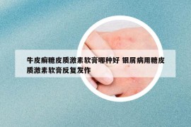 牛皮癬糖皮質(zhì)激素軟膏哪種好 銀屑病用糖皮質(zhì)激素軟膏反復(fù)發(fā)作