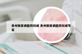 貴州銀屑病醫(yī)院權(quán)威 貴州銀屑病醫(yī)院權(quán)威專家