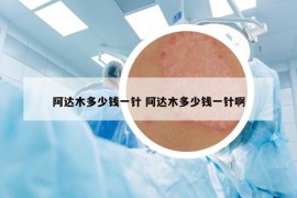 阿達(dá)木多少錢(qián)一針 阿達(dá)木多少錢(qián)一針啊