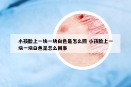 小孩臉上一塊一塊白色是怎么回 小孩臉上一塊一塊白色是怎么回事