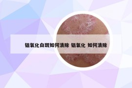 鋁氧化白斑如何清除 鋁氧化 如何清除