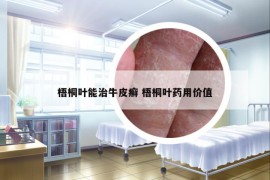 梧桐葉能治牛皮癬 梧桐葉藥用價值