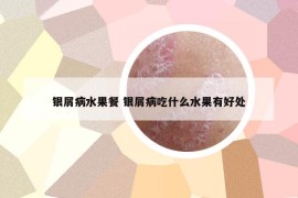 銀屑病水果餐 銀屑病吃什么水果有好處