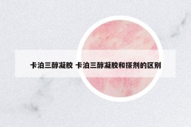 卡泊三醇凝膠 卡泊三醇凝膠和搽劑的區(qū)別