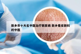 新鄉(xiāng)市十大名中醫(yī)治療銀屑病 新鄉(xiāng)看皮膚科的中醫(yī)