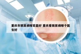 重慶市銀屑病哪家最好 重慶看銀屑病哪個醫(yī)生好