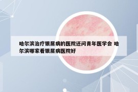 哈爾濱治療銀屑病的醫(yī)院還問青年醫(yī)學(xué)會 哈爾濱哪家看銀屑病醫(yī)院好