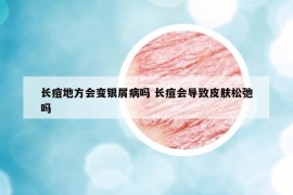 長痘地方會(huì)變銀屑病嗎 長痘會(huì)導(dǎo)致皮膚松弛嗎