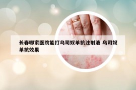 長春哪家醫(yī)院能打烏司奴單抗注射液 烏司奴單抗效果