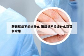 新銀屑病不能吃什么 銀屑病不能吃什么蔬菜和水果
