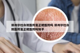 鄭州華柱白斑醫(yī)院是正規(guī)醫(yī)院嗎 鄭州華柱白斑醫(yī)院是正規(guī)醫(yī)院嗎知乎
