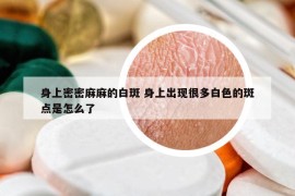 身上密密麻麻的白斑 身上出現(xiàn)很多白色的斑點(diǎn)是怎么了