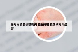 洛陽市銀屑病研究所 洛陽哪里銀屑病?？谱詈? /></a>		
		</figure>

		<header class=