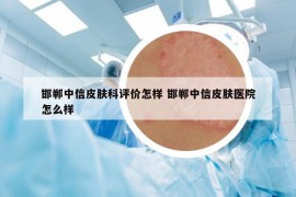 邯鄲中信皮膚科評(píng)價(jià)怎樣 邯鄲中信皮膚醫(yī)院怎么樣