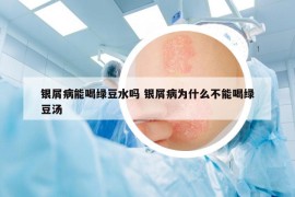 銀屑病能喝綠豆水嗎 銀屑病為什么不能喝綠豆湯