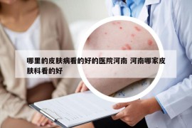哪里的皮膚病看的好的醫(yī)院河南 河南哪家皮膚科看的好