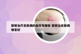 邯鄲治療皮膚病的醫(yī)院有哪些 邯鄲治皮膚病哪家好
