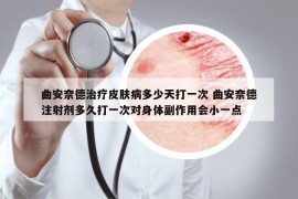 曲安奈德治療皮膚病多少天打一次 曲安奈德注射劑多久打一次對身體副作用會小一點