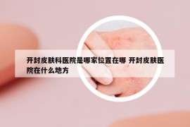 開封皮膚科醫(yī)院是哪家位置在哪 開封皮膚醫(yī)院在什么地方
