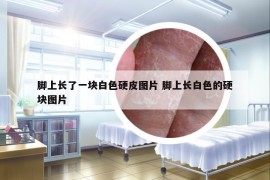 腳上長了一塊白色硬皮圖片 腳上長白色的硬塊圖片