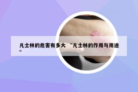 凡士林的危害有多大 “凡士林的作用與用途”