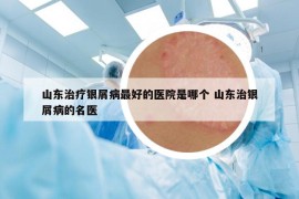 山東治療銀屑病最好的醫(yī)院是哪個 山東治銀屑病的名醫(yī)