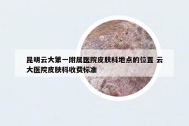 昆明云大第一附屬醫(yī)院皮膚科地點的位置 云大醫(yī)院皮膚科收費標準