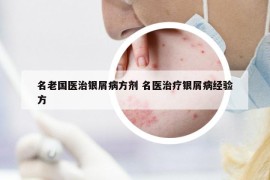 名老國醫(yī)治銀屑病方劑 名醫(yī)治療銀屑病經(jīng)驗方