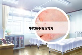 牛皮癬不告訴對方