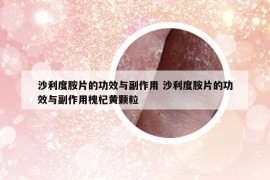 沙利度胺片的功效與副作用 沙利度胺片的功效與副作用槐杞黃顆粒