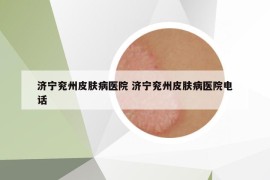 濟(jì)寧兗州皮膚病醫(yī)院 濟(jì)寧兗州皮膚病醫(yī)院電話