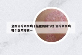 全國治療銀屑病十佳醫(yī)院排行榜 治療銀屑病哪個(gè)醫(yī)院排第一