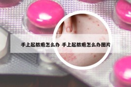 手上起膿皰怎么辦 手上起膿皰怎么辦圖片