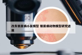 改良銀屑病小鼠模型 銀屑病動物模型研究進(jìn)展