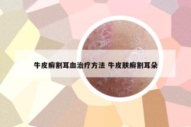 牛皮癬割耳血治療方法 牛皮膚癬割耳朵