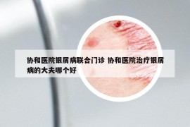 協(xié)和醫(yī)院銀屑病聯(lián)合門診 協(xié)和醫(yī)院治療銀屑病的大夫哪個(gè)好