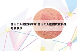 唐山工人皮膚科專家 唐山工人醫(yī)院皮膚科掛號費多少